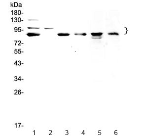 Western blot testing of human 1) HeLa, 2) COLO320, 3) U-87 MG, 4) SGC-7901, 5) rat PC-12 and 6) mous