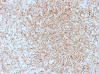 IHC staining of FFPE human spleen with CD137 antibody (clone 4-1BB/3201). HIER: boil tissue sections