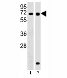 Western blot testing of RBPJ antibody at 1:2000 dilution and 1) Ramos, 2) human pancreas lysate; Pre