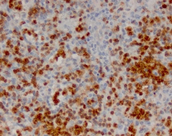 IHC staining of FFPE human lymph node with ANXA1 antibody (clone ANNX1-1). HIER: boil tissue section