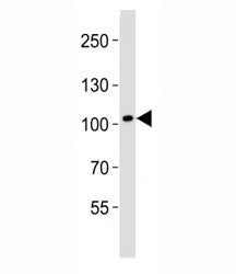 DDR1 Antibody