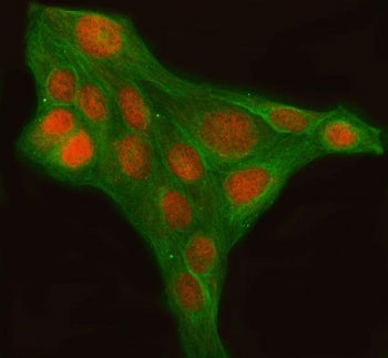LHX6 Antibody / LIM homeobox protein 6