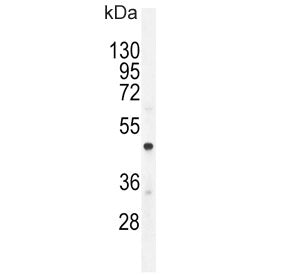 Western blot testing of human A549 cell lysate with CMGA antibody. Expected molecular weight: 50-75 