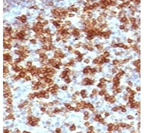 PDCD1 Antibody / PD-1 / PD1