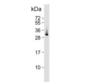 Western blot testing of human lung tissue lysate with ELOVL6 antibody. Predicted molecular weight ~3