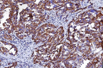 HRS Antibody / HGS / HGF-regulated tyrosine kinase substrate