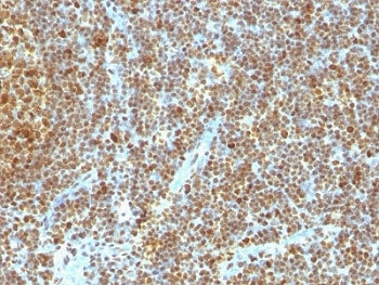 IHC analysis of formalin-fixed, paraffin-embedded human tonsil stained with anti-PCNA antibody (clon