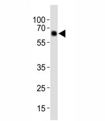Western blot analysis of lysate from human placenta tissue, using Park6/ PINK1 antibody diluted at 1