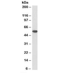 Western blot testing of Jurkat lysate with biotinylated Annexin A11 antibody at 1ug/ml. Predicted mo