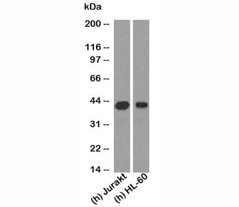 Western blot testing of human samples with RUNX3 antibody at 2 ug/ml. Predicted molecular weight: ~4