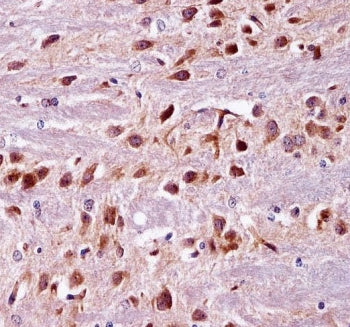 PRKCA Antibody / PKC alpha