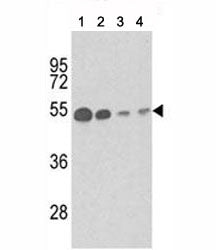 Western blot analysis of b-Tubulin antibody and (1) mouse brain tissue, (2) Y79, (3) CEM and (4) 293
