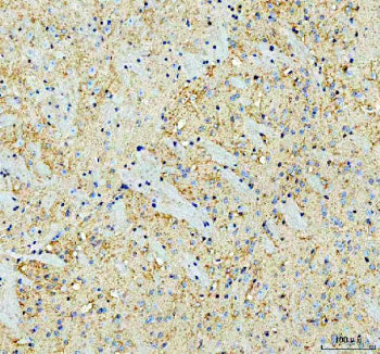 Immunohistochemical staining of SNCA using anti-SNCA antibody. SNCA was detected in a paraffin-embed