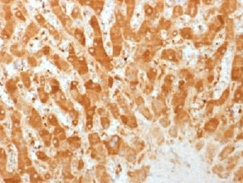 IHC testing of FFPE human liver with Connexin 32 antibody (clone GJB1/1753). Required HIER: boil tis