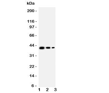 Western blot testing of TRAM2 antbody; Lane 1: Recombinant mouse protein 10ng; 2: 5ng; 3: 2.5ng