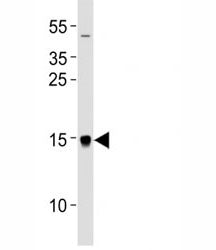 MAP1LC3A Antibody