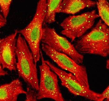 Immunofluorescent staining of TGIF2 using anti-TGIF2 antibody (green) and anti-Beta Tubulin antibody