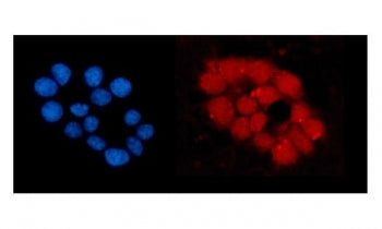 Immunofluorescent staining of FFPE human MCF-7 cells with ORC5L antibody (red) and DAPI nuclear stai