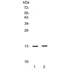 Western blot testing of different lots of human placenta lysate with PLAC9 antibody at 0.5ug/ml. Pre