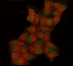 Immunofluorescent staining of FFPE human MCF7 cells with POLR3D antibody (green) and Beta Tubulin mA