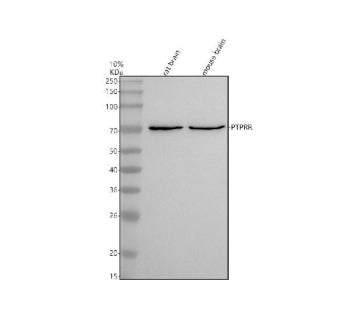 Western blot analysis of PTPRR using anti-PTPRR antibody. Electrophoresis was performed on a 10% SDS