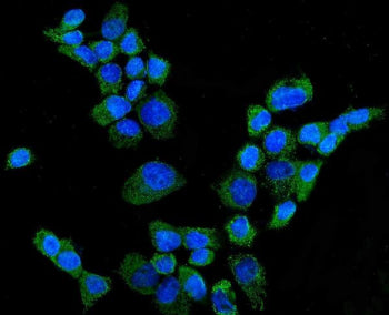 Immunofluorescent staining of FFPE human A431 cells with CYP27A1 antibody (green) and DAPI nuclear s