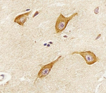 IHC testing of FFPE human brain tissue with PIP4K2 alpha antibody. HIER: steam section in pH6 citrat