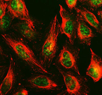 Immunofluorescent staining of TOX3 using anti-TOX3 antibody (green) and anti-Beta Tubulin antibody (