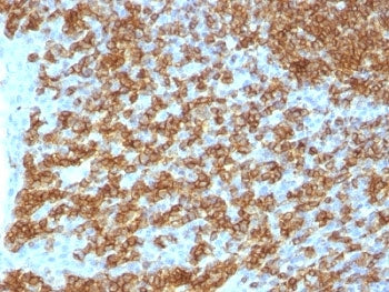 CD45RA Antibody (Leukocyte marker)