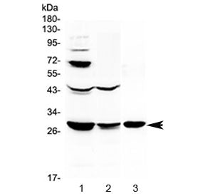 Western blot testing of 1) rat liver, 2) rat kidney and 3) mouse kidney lysate with TL1A antibody at