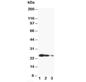 TIMP3 Antibody