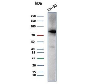 Western blot testing of human RH30 cell lysate with Catenin Beta antibody (clone CTNNB1/7760). Expec
