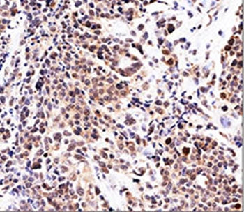 p21 Antibody / CDKN1A