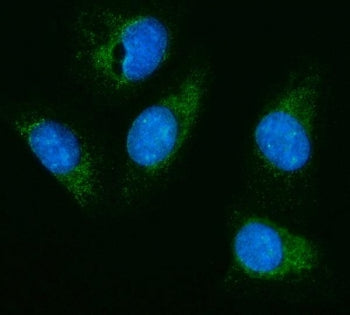 HEXA Antibody / Hexosaminidase A