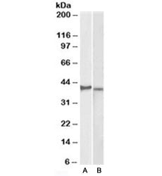 Western blot testing of KELLY [A] and U251-MG [B] lysates with CX3CR1 antibody at 2ug/ml. Predicted 