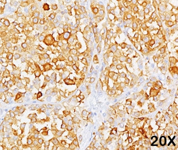MART-1 / Melan-A Antibody