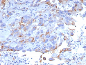 IHC staining of FFPE human bladder tissue with PEIG-1 antibody (clone GPRC5A/7893). HIER: boil tissu