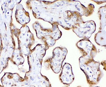 TIMP2 Antibody
