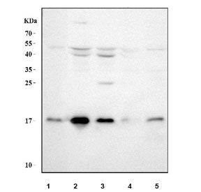 Western blot testing of 1) human placenta, 2) human K562, 3) human HepG2, 4) rat brain and 5) rat ki