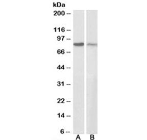 Western blot testing of human A431 [A] and mouse NIH3T3 [B] cell lysates with Gamma Catenin antibody