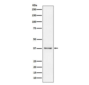 Western blot testing of human Raji cell lysate with CD23 antibody. Expected molecular weight: 37-45 