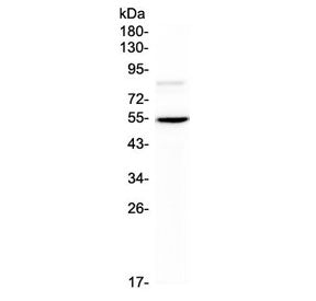 Western blot testing of mouse HEPA1-6 cell lysate with ANGPTL3 antibody at 0.5ug/ml. Expected molecu