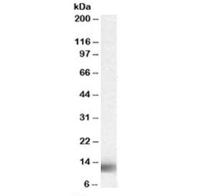 Western blot testing of Jurkat lysate with MPS1 antibody at 0.03ug/ml. Predicted molecular weight: ~