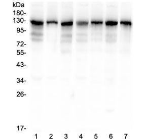 Western blot testing of human 1) HeLa, 2) HepG2, 3) A549, 4) PANC-1, 5) SK-OV-3, 6) SGC-7901 and 7) 