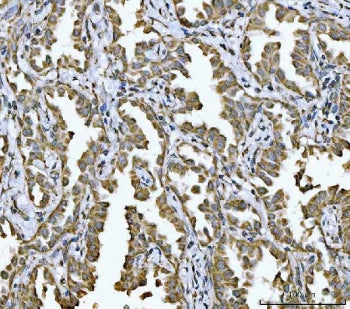 NDUFV2 Antibody