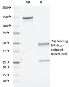 TGF Beta 1/2/3 Antibody / TGFB1/2/3