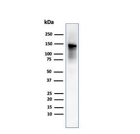 Western blot testing of human ovary tissue lysate using Caldesmon antibody (clone rCALD1/820). Predi