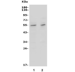 Western blot testing of mouse 1) thymus and 2) lung lysate with Ifngr2 antibody. Observed molecular 