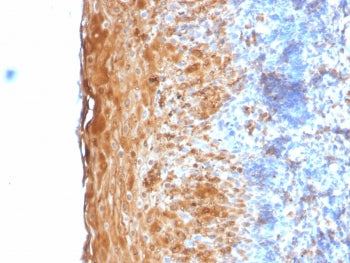 IHC testing of FFPE human tonsil with recombinant Involucrin antibody (clone IVRN/2113R). Staining o