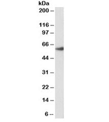 Western blot testing of rat lung lysate with biotinylated FOXA2 antibody at 1.5ug/ml. An NAP blocker